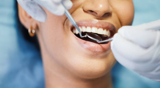 Best Emergency Tooth Extraction in Grantville, GA